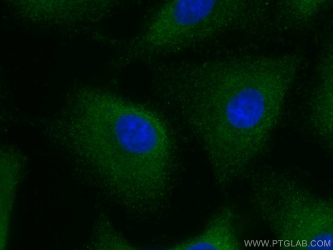 MMP3 Antibody in Immunocytochemistry (ICC/IF)