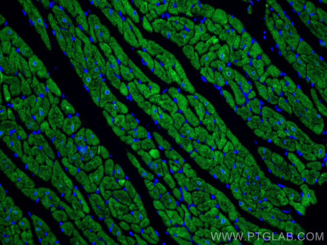 Calsequestrin 2 Antibody in Immunohistochemistry (Paraffin) (IHC (P))