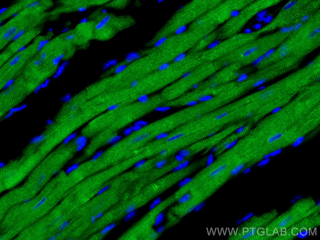 Calsequestrin 2 Antibody in Immunohistochemistry (Paraffin) (IHC (P))