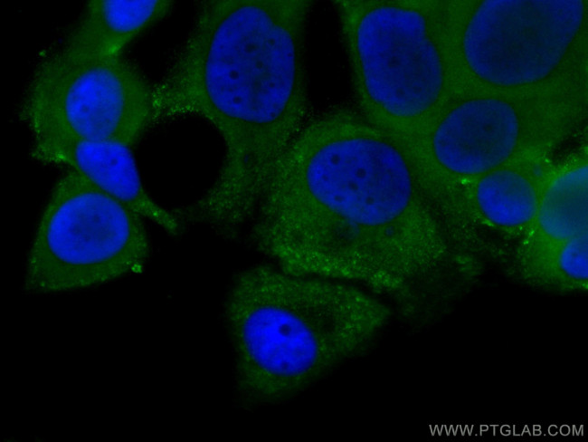 GDI1 Antibody in Immunocytochemistry (ICC/IF)