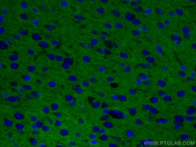 Syntaxin 1A/Syntaxin 1B Antibody in Immunohistochemistry (Paraffin) (IHC (P))