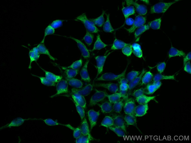 Hsc70 Antibody in Immunocytochemistry (ICC/IF)