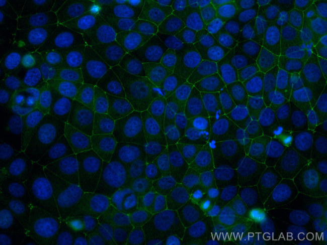 ZO-1 Antibody in Immunocytochemistry (ICC/IF)