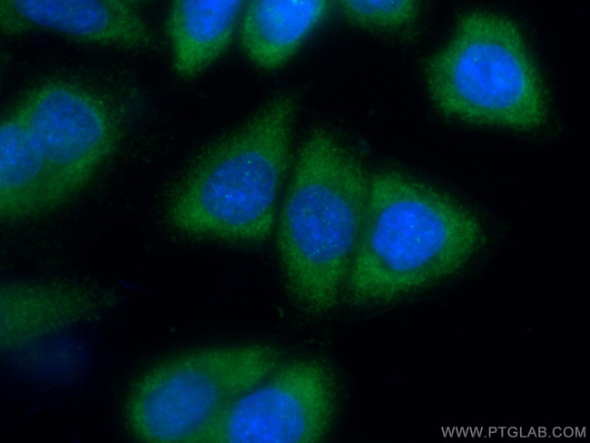 IKBKG Antibody in Immunocytochemistry (ICC/IF)