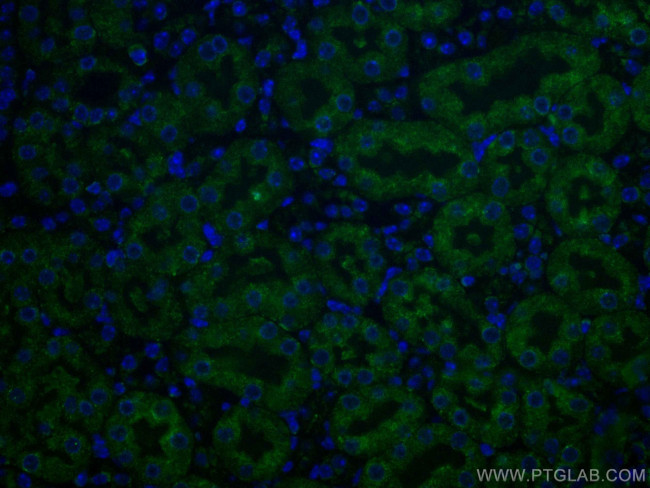 Caspase 3/p17/p19 Antibody in Immunohistochemistry (Paraffin) (IHC (P))