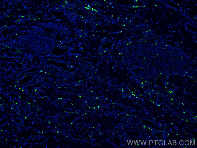 PSAP Antibody in Immunohistochemistry (Paraffin) (IHC (P))