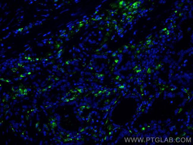 PSAP Antibody in Immunohistochemistry (Paraffin) (IHC (P))