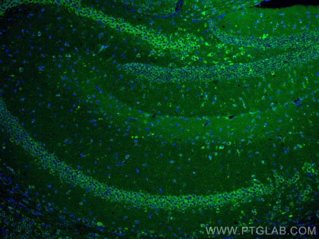 MFF Antibody in Immunohistochemistry (Paraffin) (IHC (P))