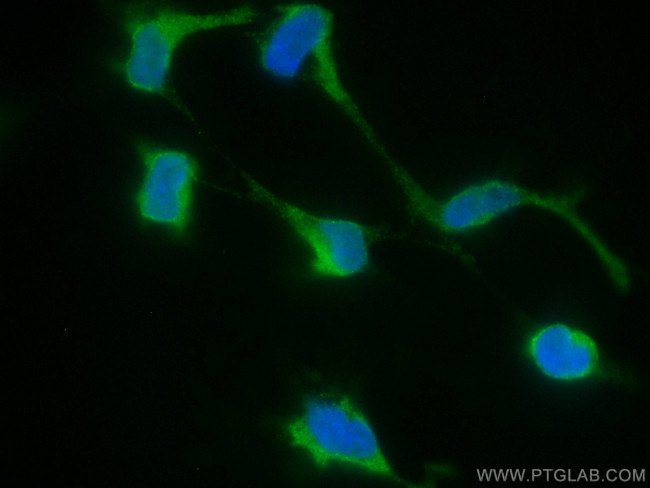 STAT1 Antibody in Immunocytochemistry (ICC/IF)