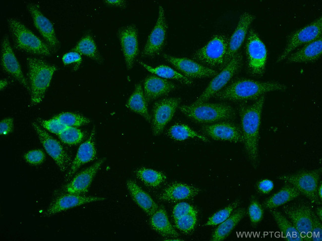 ATF6 Antibody in Immunocytochemistry (ICC/IF)