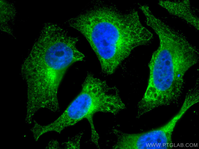 WBP2 Antibody in Immunocytochemistry (ICC/IF)