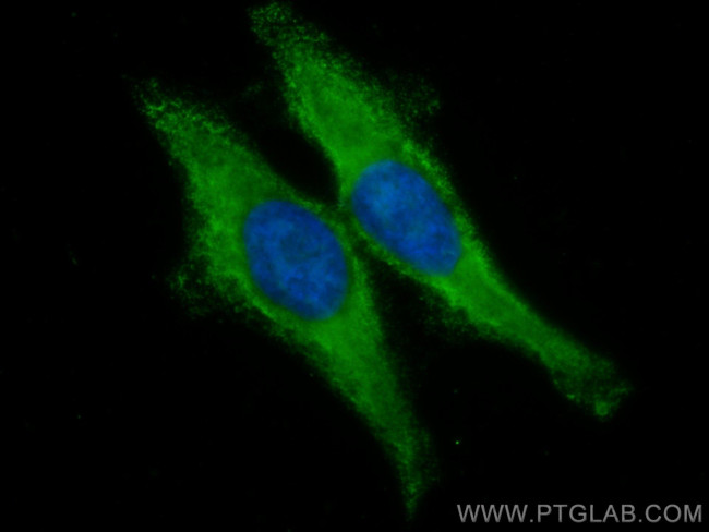 Beta Galactosidase Antibody in Immunocytochemistry (ICC/IF)