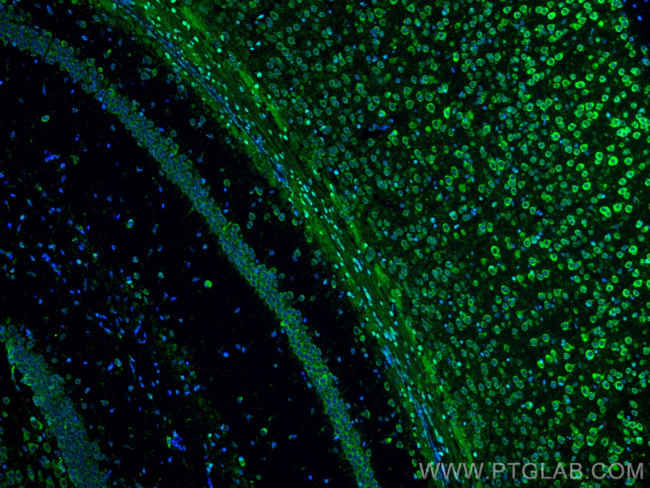 RIC8A Antibody in Immunohistochemistry (Paraffin) (IHC (P))