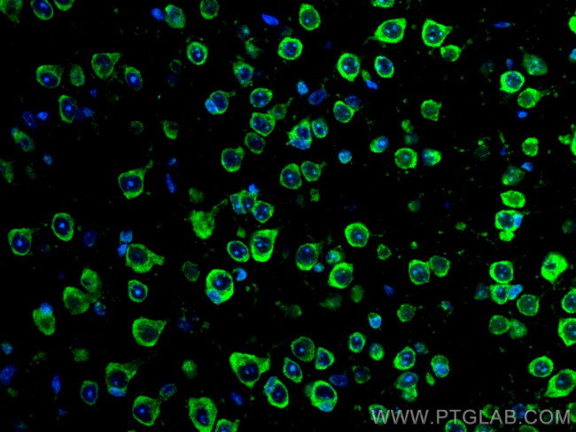 RIC8A Antibody in Immunohistochemistry (Paraffin) (IHC (P))