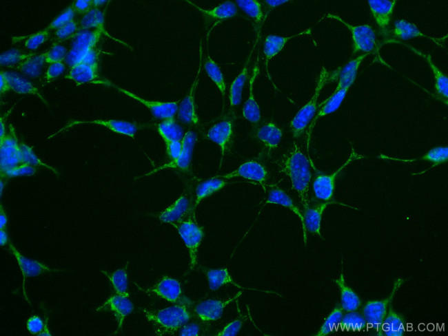 RAB3GAP1 Antibody in Immunocytochemistry (ICC/IF)