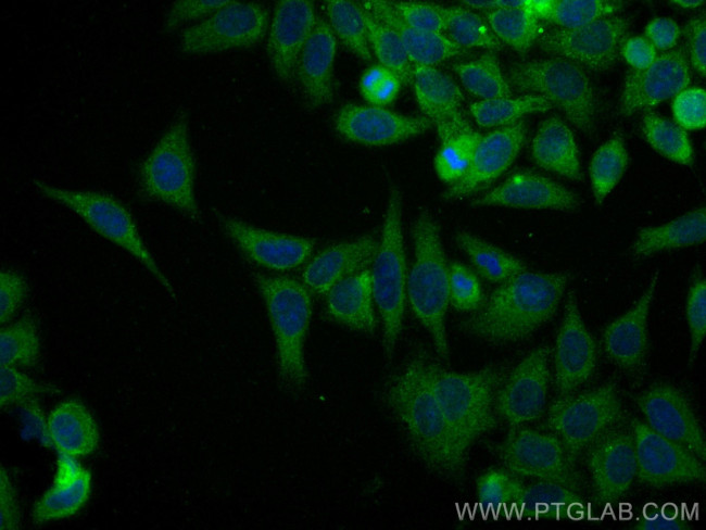 GSTP1 Antibody in Immunocytochemistry (ICC/IF)