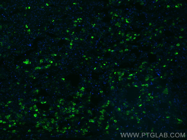 TSH Beta Antibody in Immunohistochemistry (Paraffin) (IHC (P))