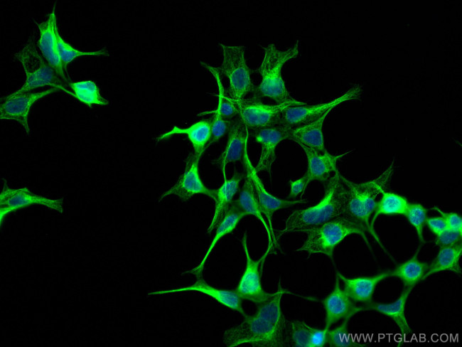 DKK3 Antibody in Immunocytochemistry (ICC/IF)