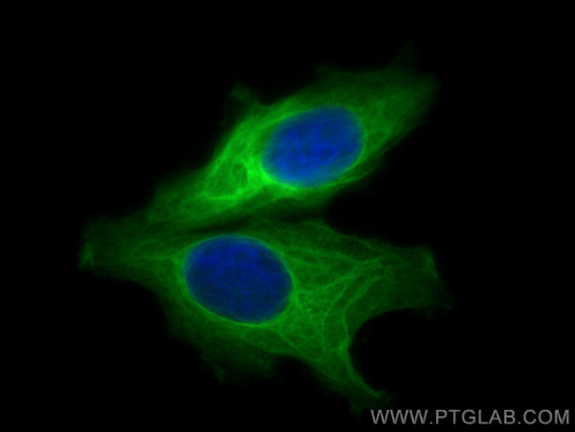 HSP27 Antibody in Immunocytochemistry (ICC/IF)