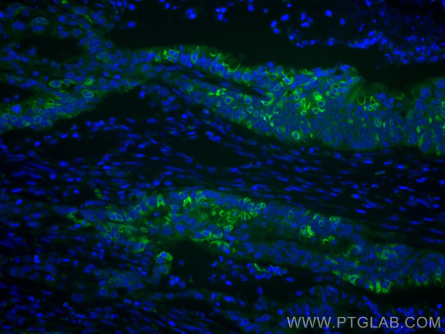 AGR2 Antibody in Immunohistochemistry (Paraffin) (IHC (P))