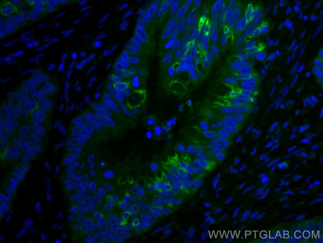 AGR2 Antibody in Immunohistochemistry (Paraffin) (IHC (P))