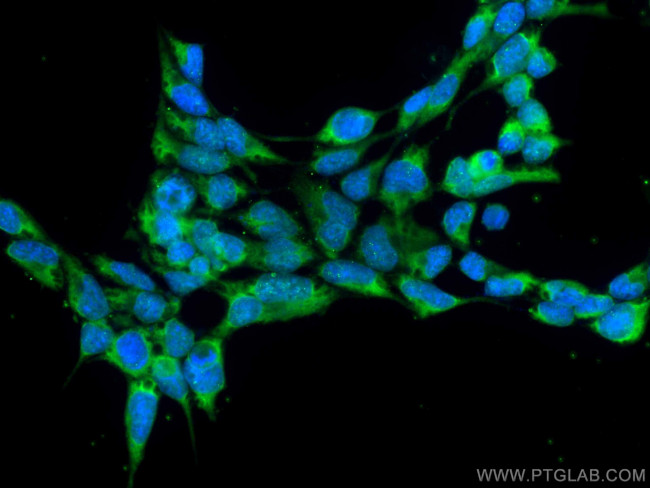 CRACR2A Antibody in Immunocytochemistry (ICC/IF)