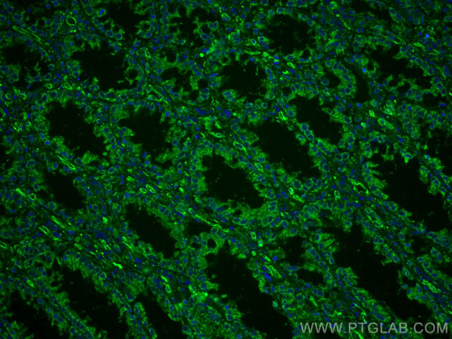 XIAP Antibody in Immunohistochemistry (Paraffin) (IHC (P))