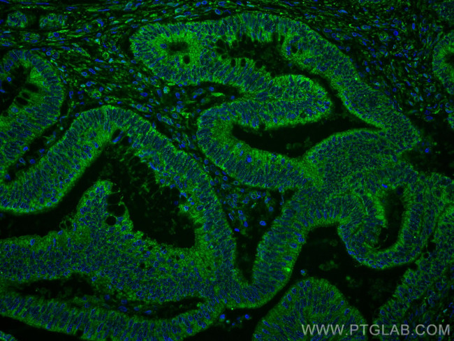 XIAP Antibody in Immunohistochemistry (Paraffin) (IHC (P))