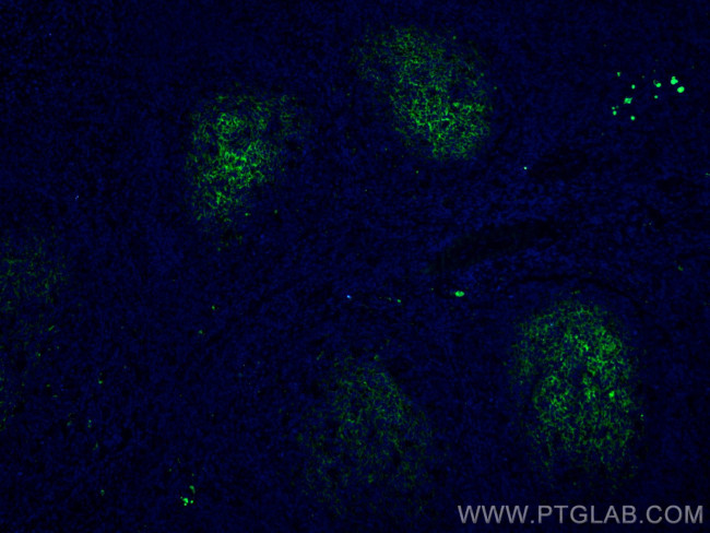 CD82 Antibody in Immunohistochemistry (Paraffin) (IHC (P))