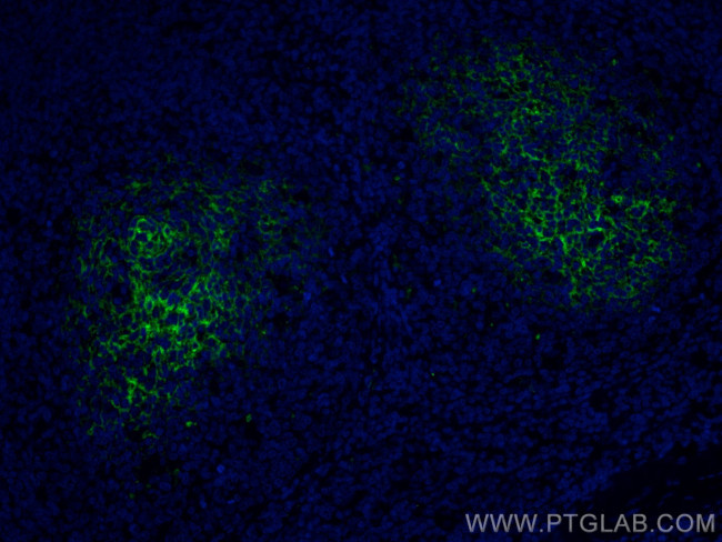 CD82 Antibody in Immunohistochemistry (Paraffin) (IHC (P))