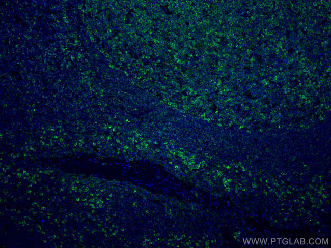 CD81 Antibody in Immunohistochemistry (Paraffin) (IHC (P))