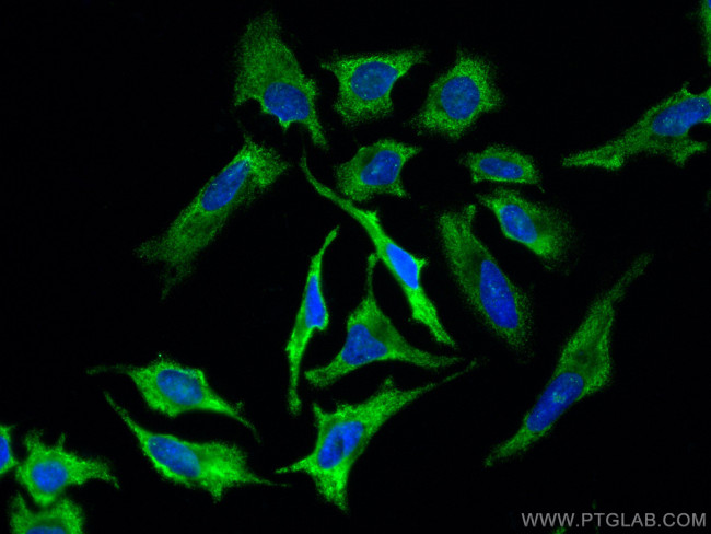 GRB2 Antibody in Immunocytochemistry (ICC/IF)