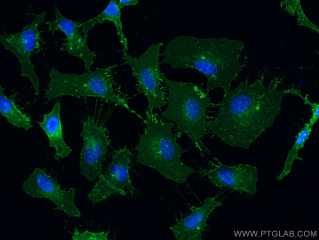 CD98/SLC3A2 Antibody in Immunocytochemistry (ICC/IF)