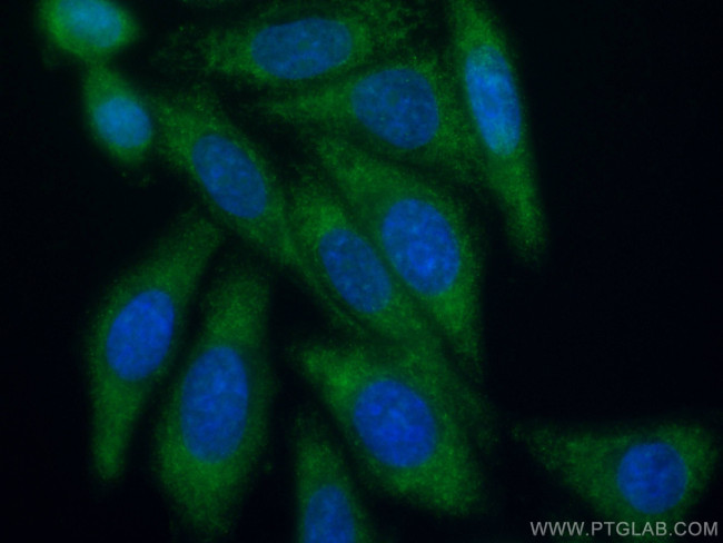 NFATC2 Antibody in Immunocytochemistry (ICC/IF)