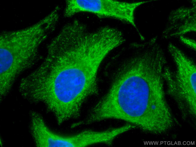 GPNMB Antibody in Immunocytochemistry (ICC/IF)