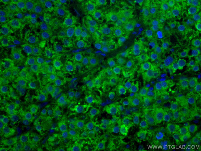 ADK Antibody in Immunohistochemistry (Paraffin) (IHC (P))