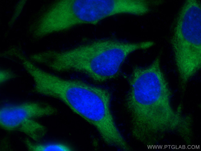 RACK1, GNB2L1 Antibody in Immunocytochemistry (ICC/IF)