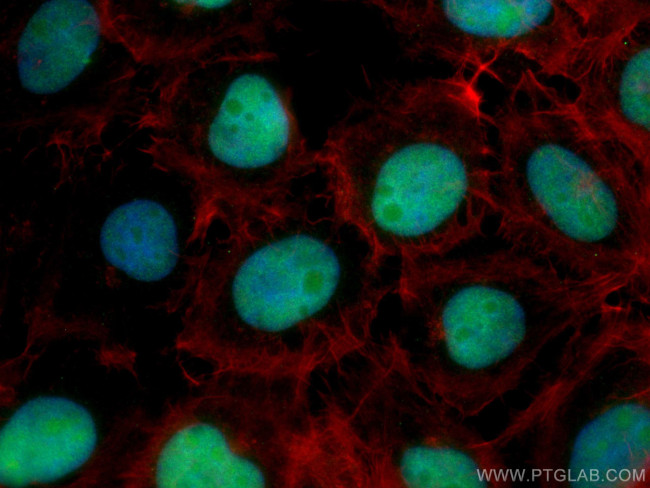 DBR1 Antibody in Immunocytochemistry (ICC/IF)