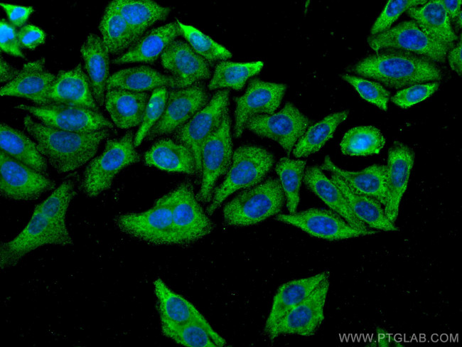 FGFR3 Antibody in Immunocytochemistry (ICC/IF)