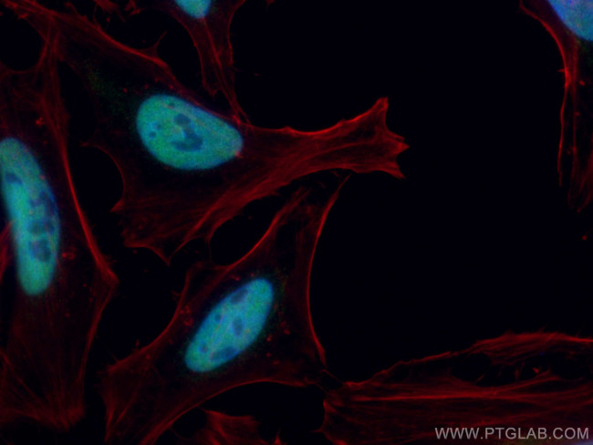 TBL1X Antibody in Immunocytochemistry (ICC/IF)