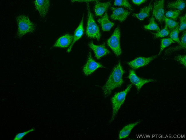 FOX2/RBM9 Antibody in Immunocytochemistry (ICC/IF)