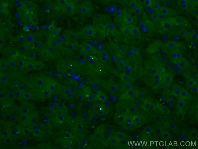 FTCD Antibody in Immunohistochemistry (Paraffin) (IHC (P))