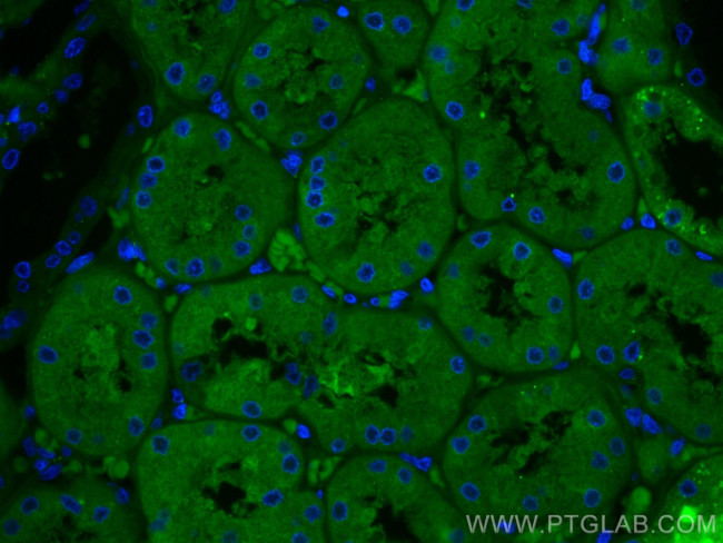 FTCD Antibody in Immunohistochemistry (Paraffin) (IHC (P))