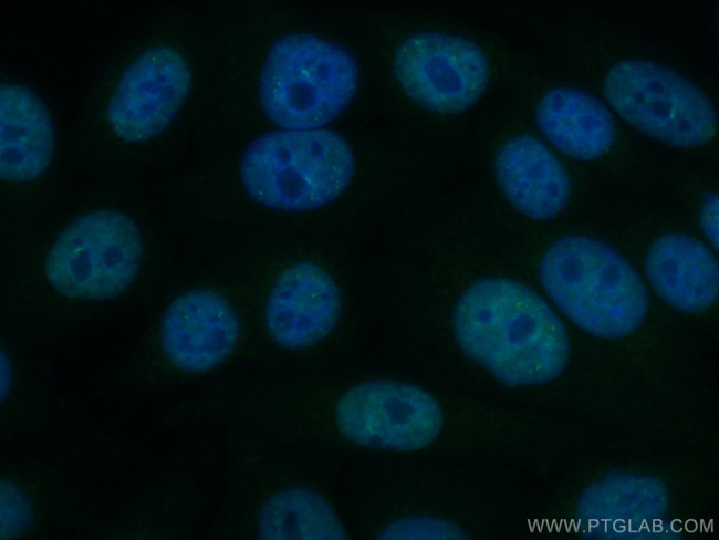 NEIL1 Antibody in Immunocytochemistry (ICC/IF)