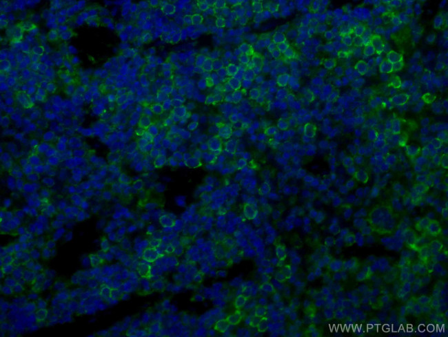 ICAM4 Antibody in Immunohistochemistry (Paraffin) (IHC (P))