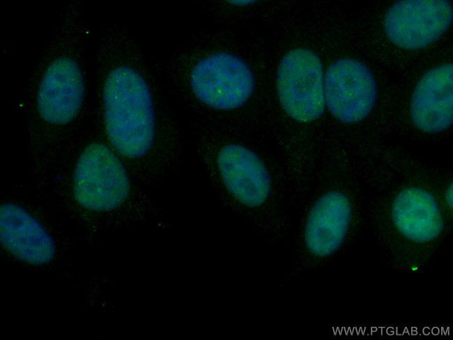 DDX5 Antibody in Immunocytochemistry (ICC/IF)