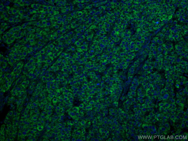 GLUD1 Antibody in Immunohistochemistry (Paraffin) (IHC (P))