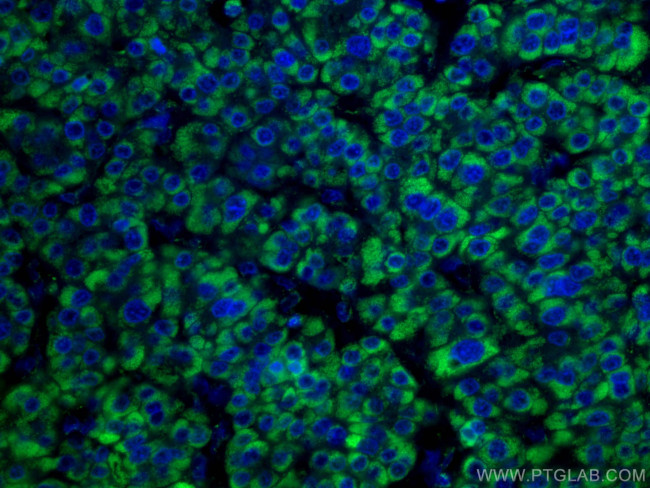 GLUD1 Antibody in Immunohistochemistry (Paraffin) (IHC (P))