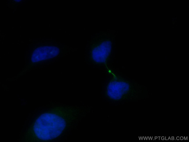 PRC1 Antibody in Immunocytochemistry (ICC/IF)