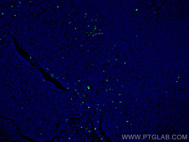 PRTN3 Antibody in Immunohistochemistry (Paraffin) (IHC (P))